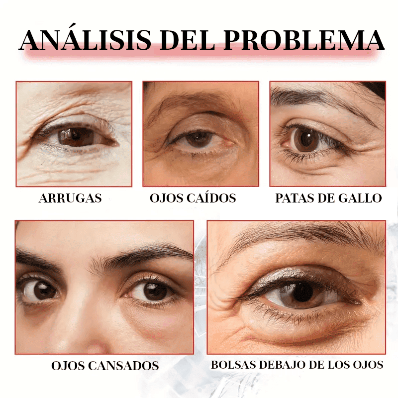Enhancing Eye Lift by NUVIA™